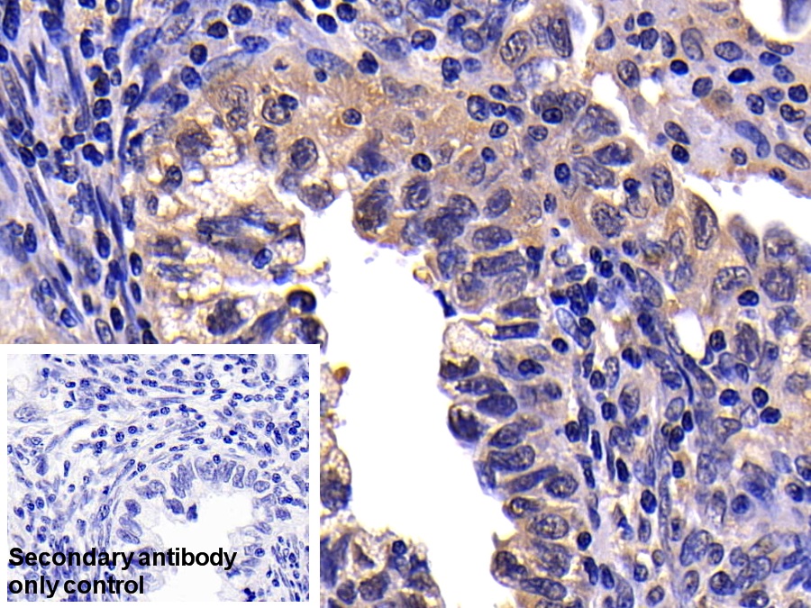 Polyclonal Antibody to Caspase 10 (CASP10)