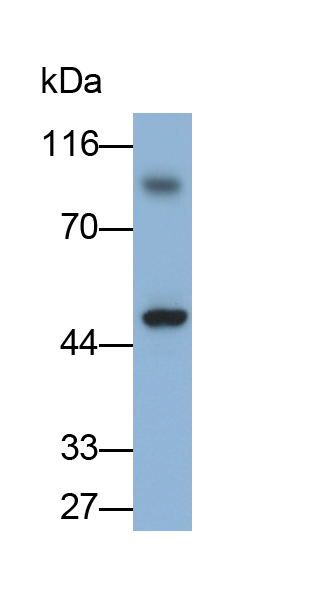 Polyclonal Antibody to Transferrin Receptor (TFR)