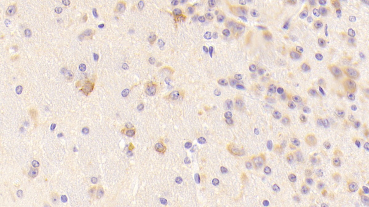 Polyclonal Antibody to Transferrin Receptor (TFR)