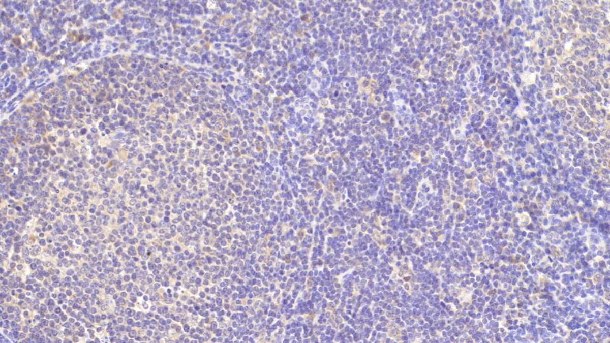 Polyclonal Antibody to Transferrin Receptor (TFR)