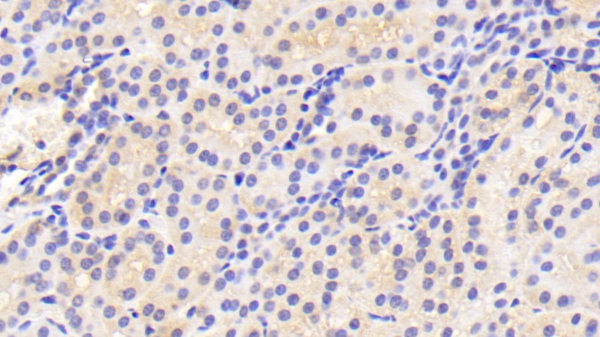 Polyclonal Antibody to Transferrin Receptor (TFR)