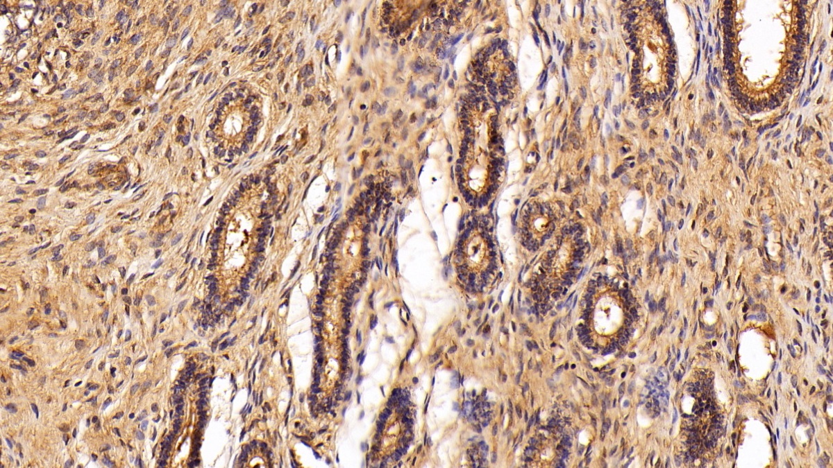 Polyclonal Antibody to Clusterin (CLU)