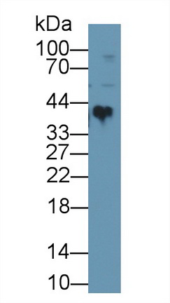 Polyclonal Antibody to Clusterin (CLU)