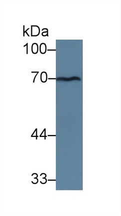 Polyclonal Antibody to Taxilin Alpha (TXLNa)