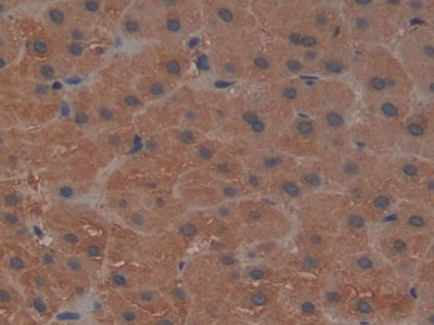 Polyclonal Antibody to Glia Maturation Factor Gamma (GMFg)