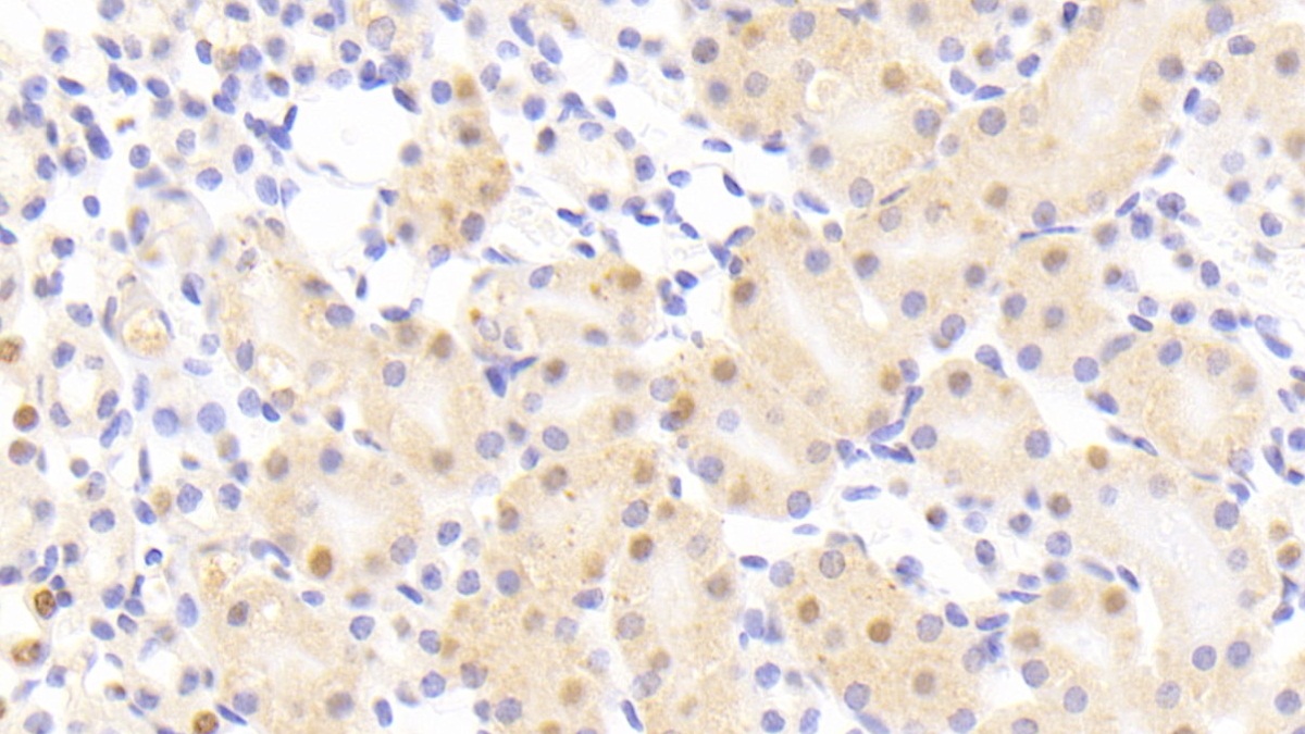 Polyclonal Antibody to Nucleoporin 88 (NUP88)
