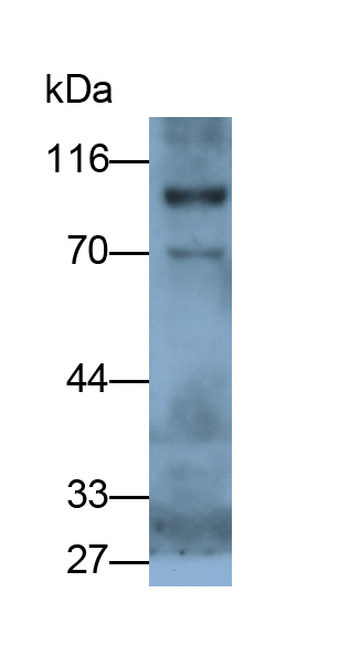Polyclonal Antibody to Nucleoporin 88 (NUP88)