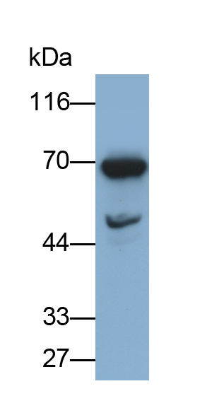 Polyclonal Antibody to Lymphocyte Cytosolic Protein 2 (LCP2)