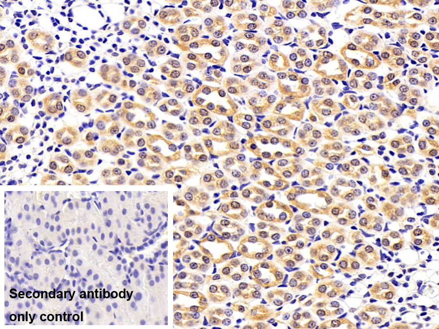 Polyclonal Antibody to Mitogen Activated Protein Kinase 14 (MAPK14)