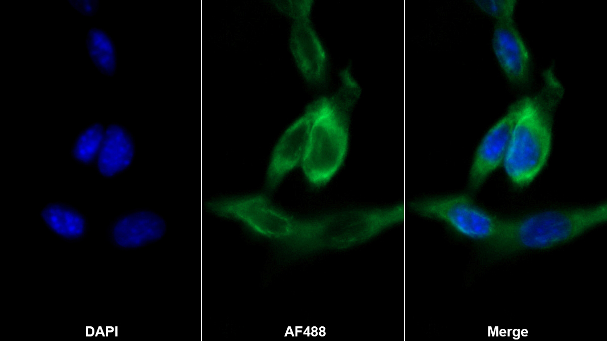 Polyclonal Antibody to Granzyme K (GZMK)