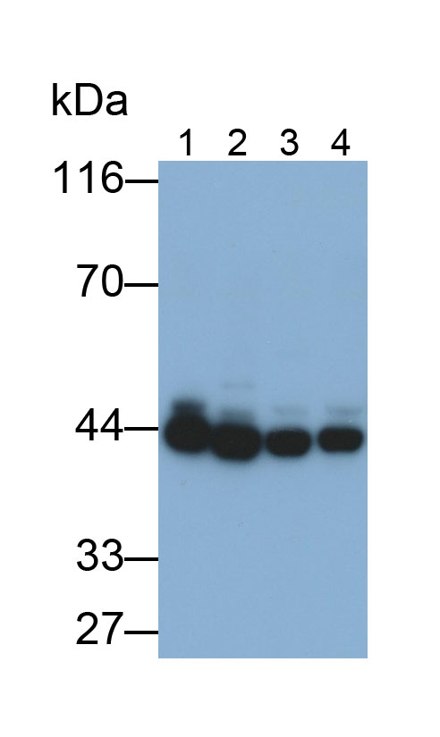 Polyclonal Antibody to Aspartate Aminotransferase (AST)