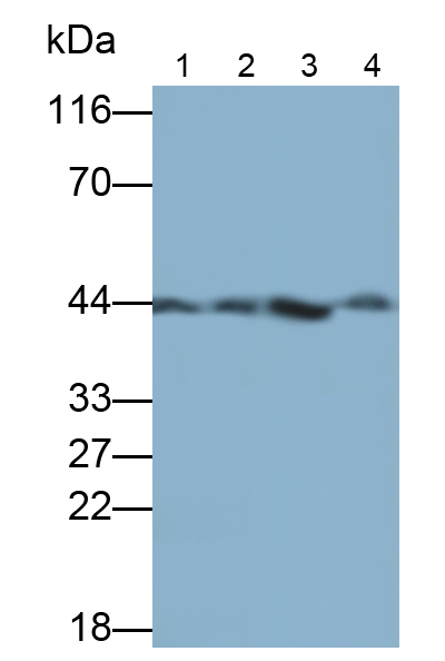 Polyclonal Antibody to Aspartate Aminotransferase (AST)