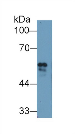 Polyclonal Antibody to Fibrinogen Beta Chain (FGB)