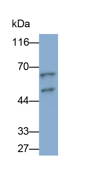 Polyclonal Antibody to Fibrinogen Beta Chain (FGB)