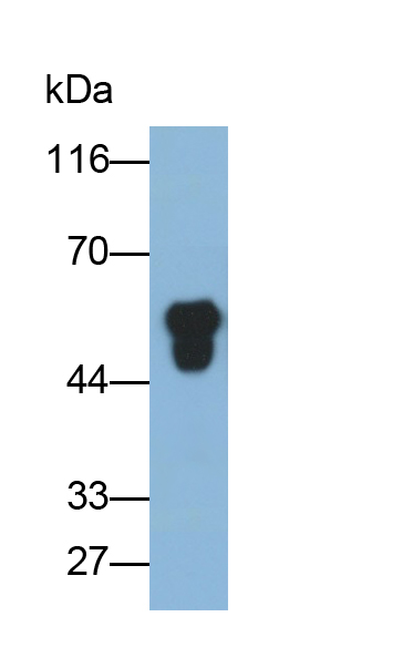 Polyclonal Antibody to Fibrinogen Beta Chain (FGB)