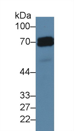 Polyclonal Antibody to Alkaline Phosphatase, Placental (ALPP)