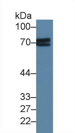 Polyclonal Antibody to Alkaline Phosphatase, Placental (ALPP)