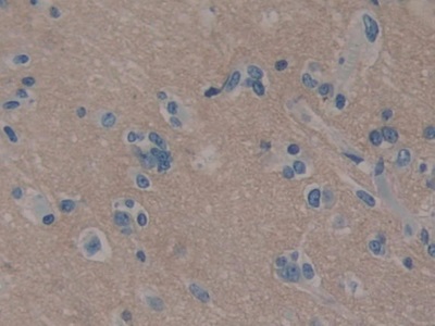 Polyclonal Antibody to Cluster Of Differentiation 56 (CD56)