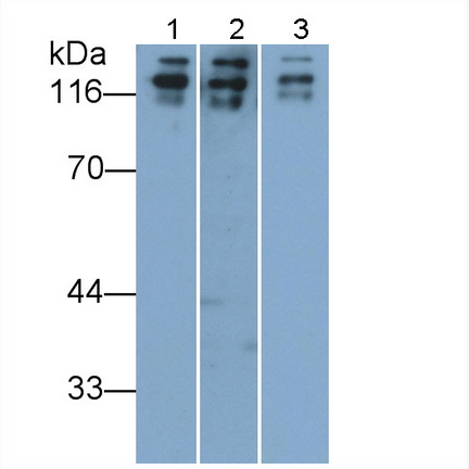 Polyclonal Antibody to Cluster Of Differentiation 56 (CD56)