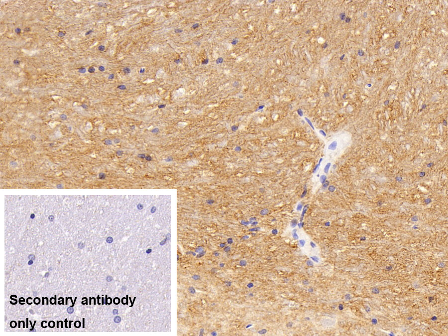 Polyclonal Antibody to Cluster Of Differentiation 56 (CD56)