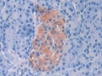 Polyclonal Antibody to Corticosteroid Binding Globulin (CBG)