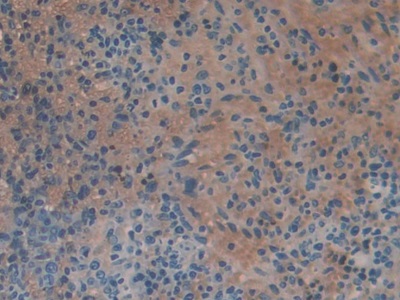 Polyclonal Antibody to Corticosteroid Binding Globulin (CBG)