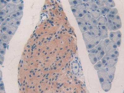 Polyclonal Antibody to Corticosteroid Binding Globulin (CBG)