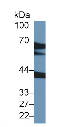 Polyclonal Antibody to Corticosteroid Binding Globulin (CBG)