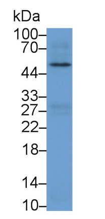 Polyclonal Antibody to Cholinergic Receptor, Muscarinic 4 (CHRM4)