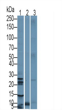 Polyclonal Antibody to Cytotoxic T-Lymphocyte Associated Antigen 4 (CTLA4)