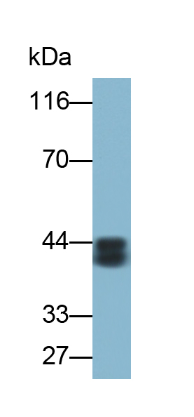 Polyclonal Antibody to Cytokeratin 18 (CK18)