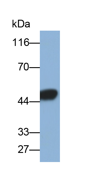 Polyclonal Antibody to Cytokeratin 18 (CK18)