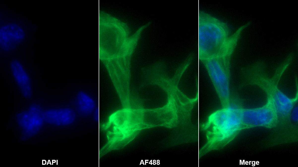 Polyclonal Antibody to Cytokeratin 18 (CK18)