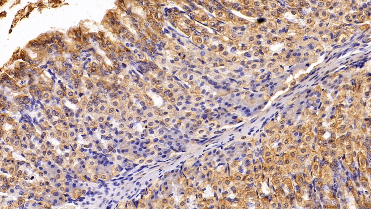 Polyclonal Antibody to Cytokeratin 19 (CK19)
