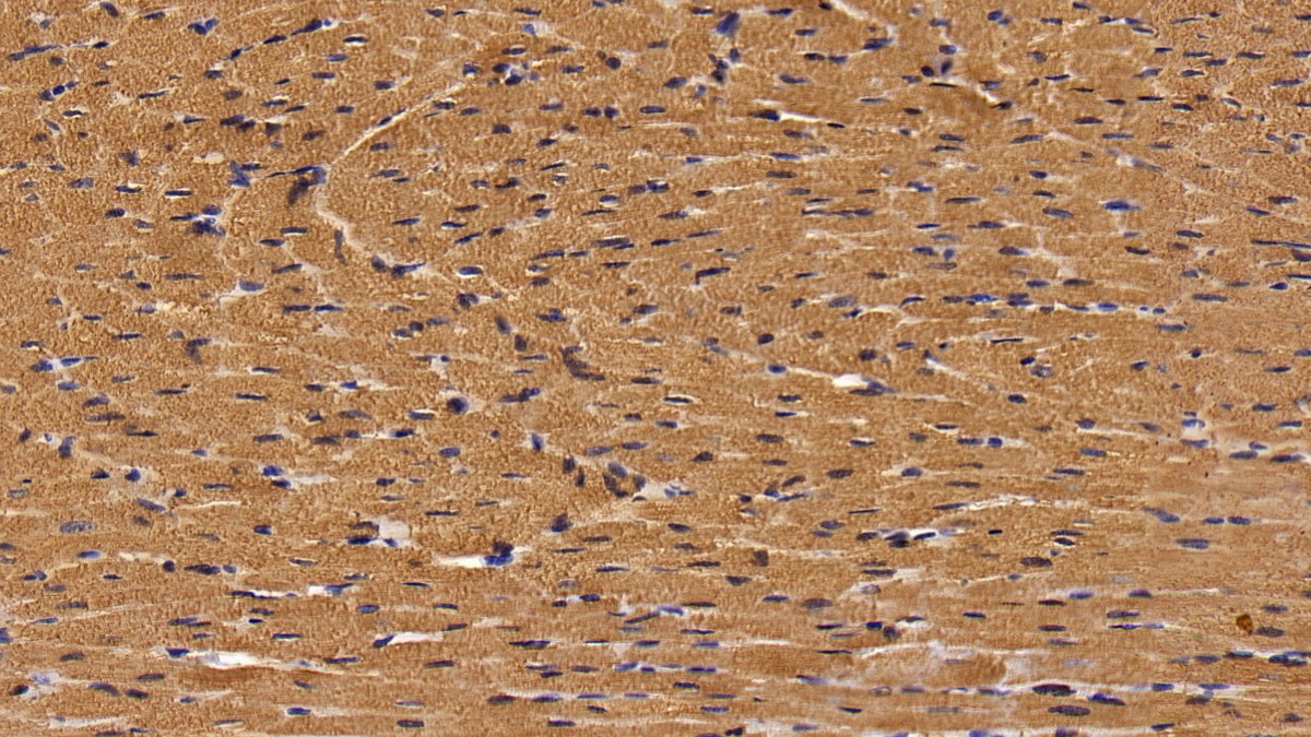 Polyclonal Antibody to Heart-type Fatty Acid Binding Protein (H-FABP)