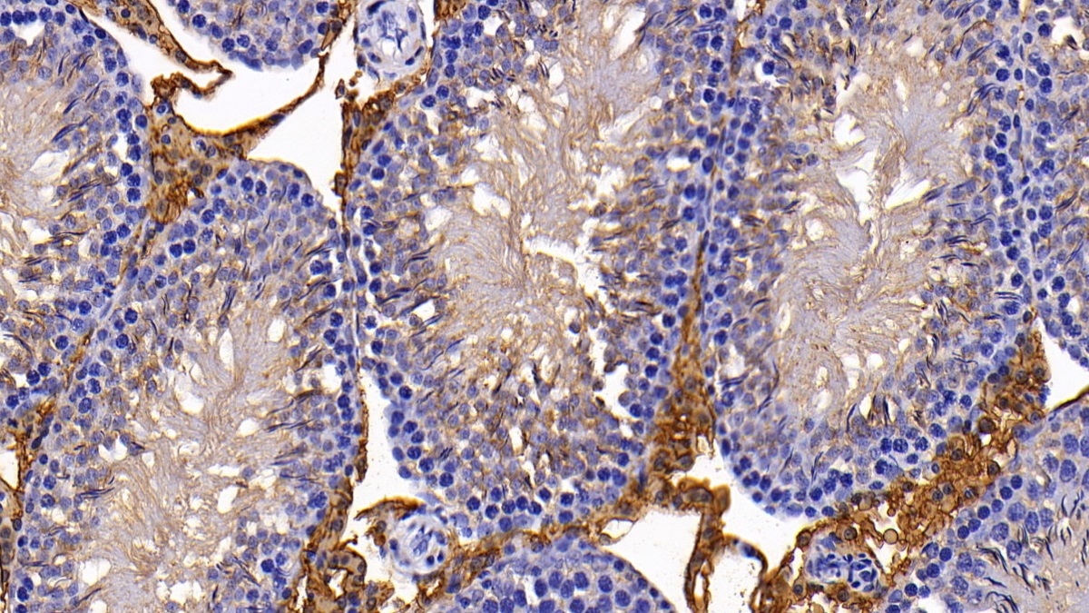 Polyclonal Antibody to Heart-type Fatty Acid Binding Protein (H-FABP)