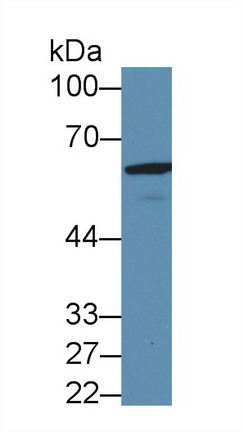 Polyclonal Antibody to Glutamate Decarboxylase 2 (GAD2)