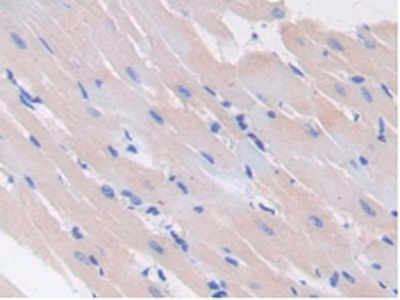 Polyclonal Antibody to Glutamate Decarboxylase 2 (GAD2)