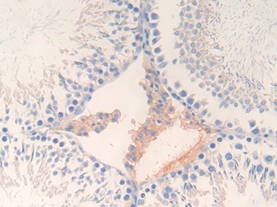 Polyclonal Antibody to Glutamate Decarboxylase 2 (GAD2)