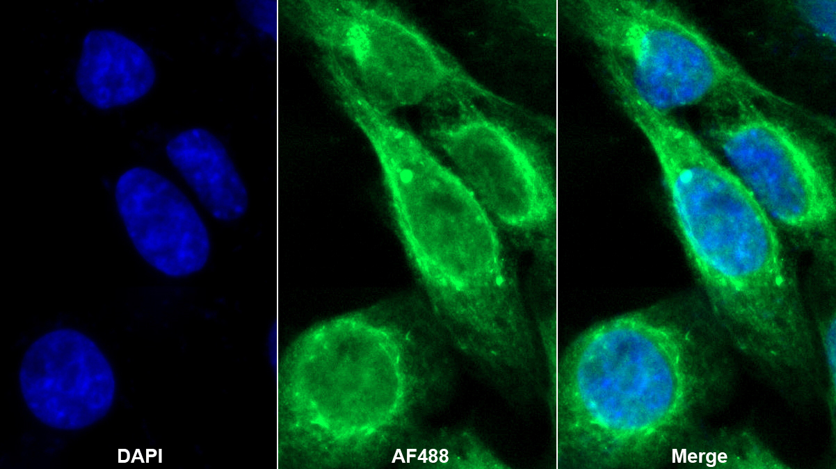 Polyclonal Antibody to Glutamate Decarboxylase 2 (GAD2)
