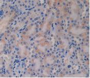 Polyclonal Antibody to Glucagon (GCG)