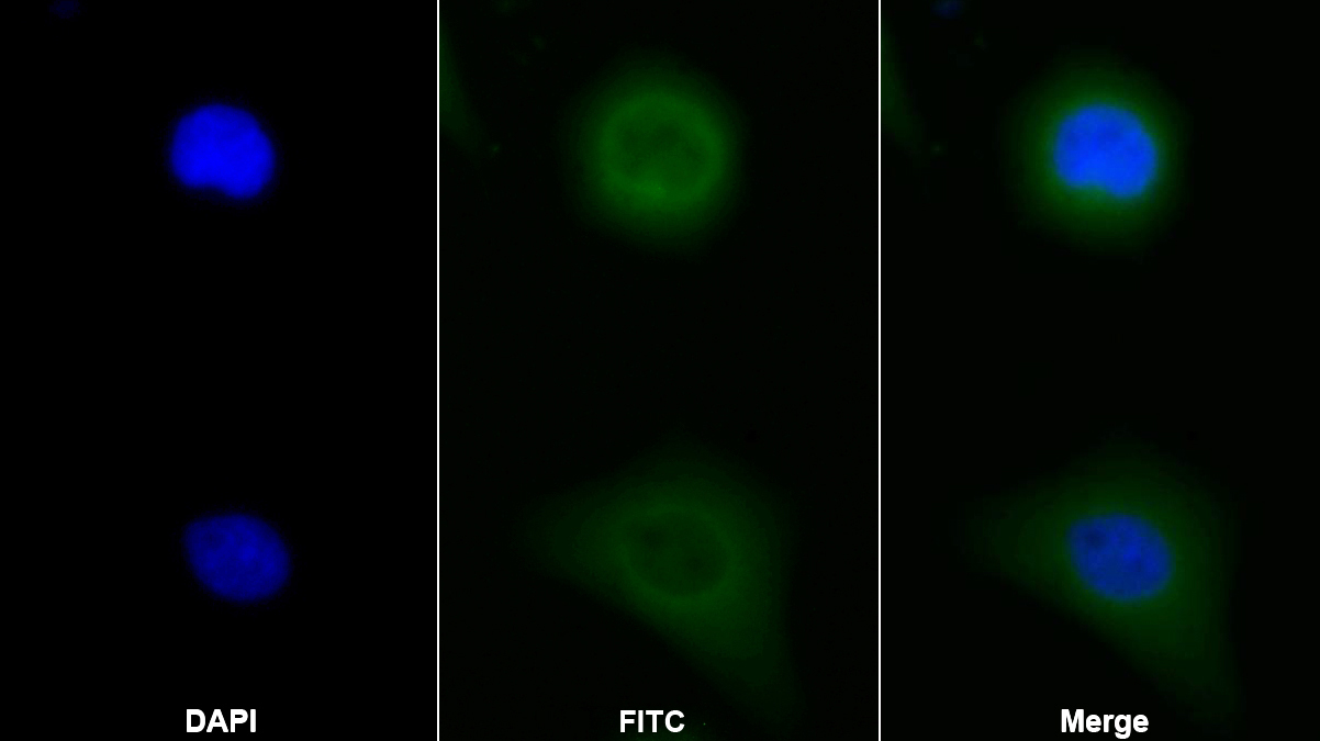 Polyclonal Antibody to Kininogen 1 (KNG1)