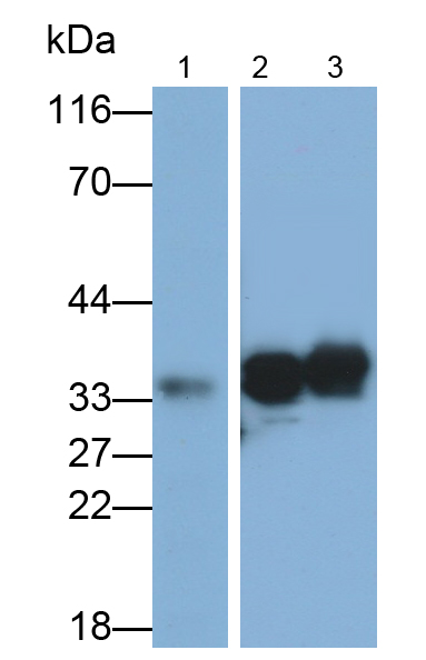 Polyclonal Antibody to Sulfotransferase 1A1 (SULT1A1)