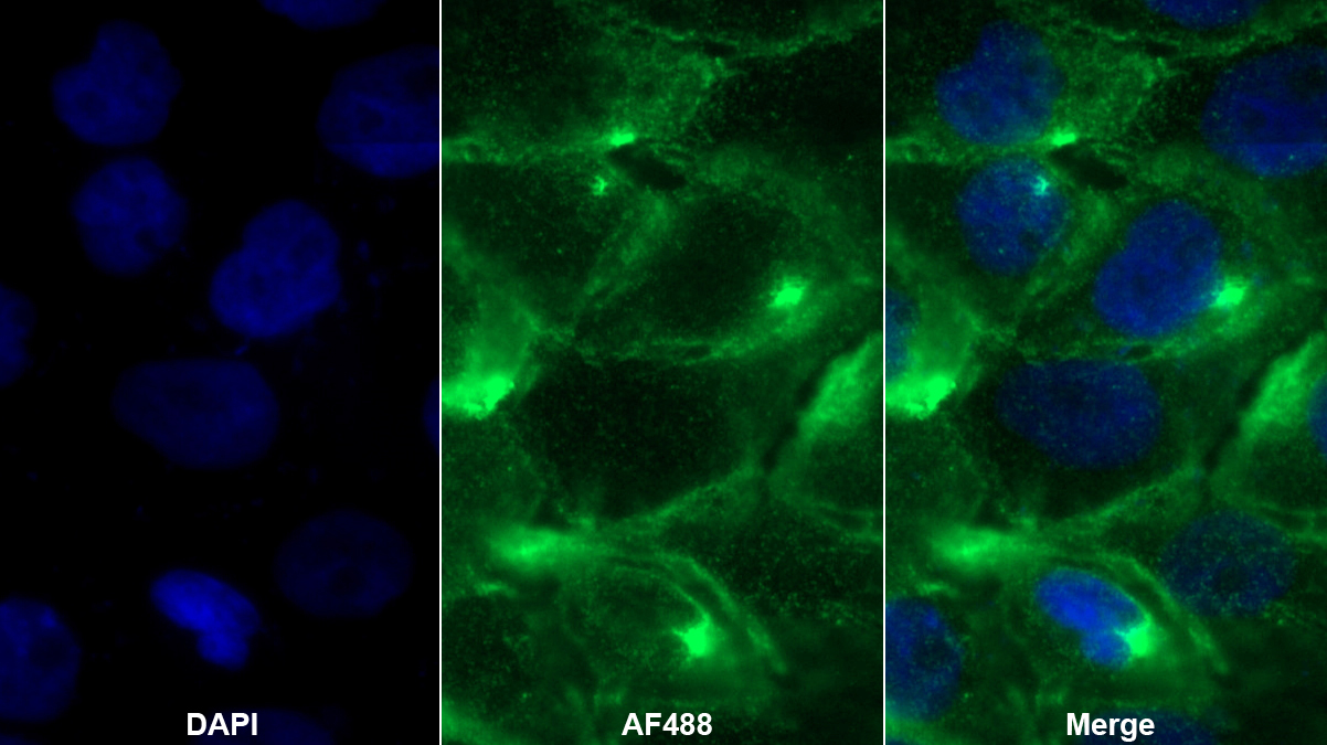 Polyclonal Antibody to Membrane Cofactor Protein (MCP)