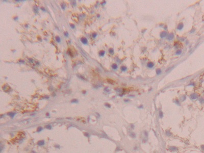 Polyclonal Antibody to Cathepsin D (CTSD)