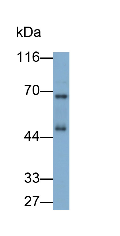 Polyclonal Antibody to Cathepsin D (CTSD)