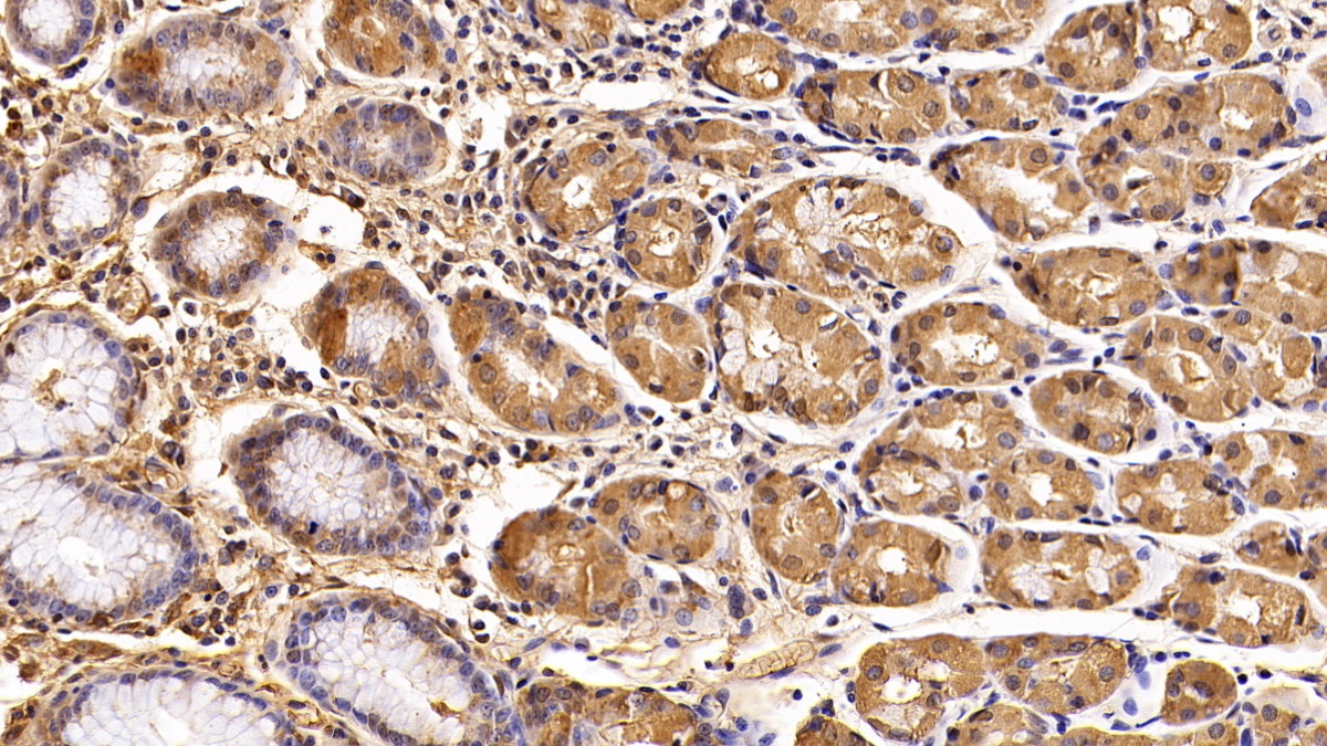 Polyclonal Antibody to Cathepsin D (CTSD)