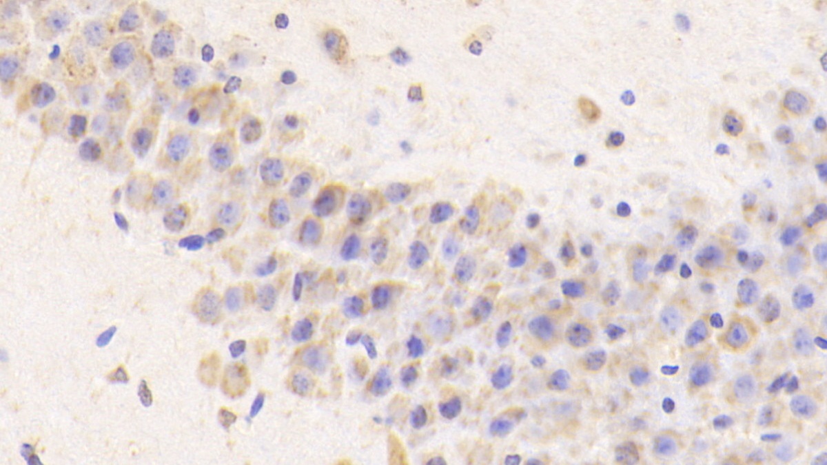 Polyclonal Antibody to Cathepsin D (CTSD)