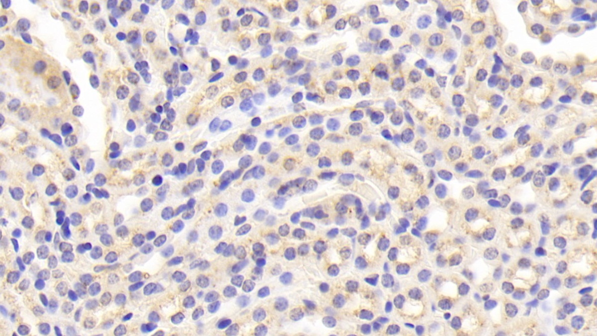 Polyclonal Antibody to Cathepsin D (CTSD)
