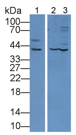 Polyclonal Antibody to Cathepsin D (CTSD)